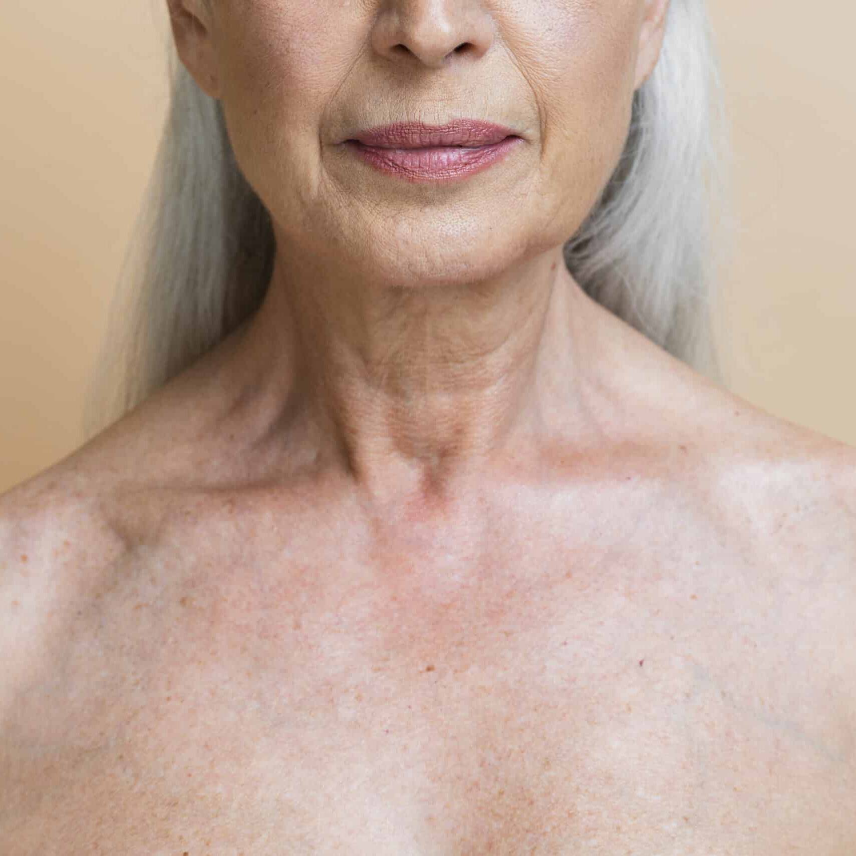 As rugas no pescoço, que costumam aparecer com o passar dos anos, também podem ser tratadas com a toxina. O objetivo é reduzir o excesso de tensão muscular que causa as linhas horizontais na região do pescoço e colo. Com o relaxamento dos músculos locais, é possível atenuar as rugas e melhorar a aparência dessa área.
