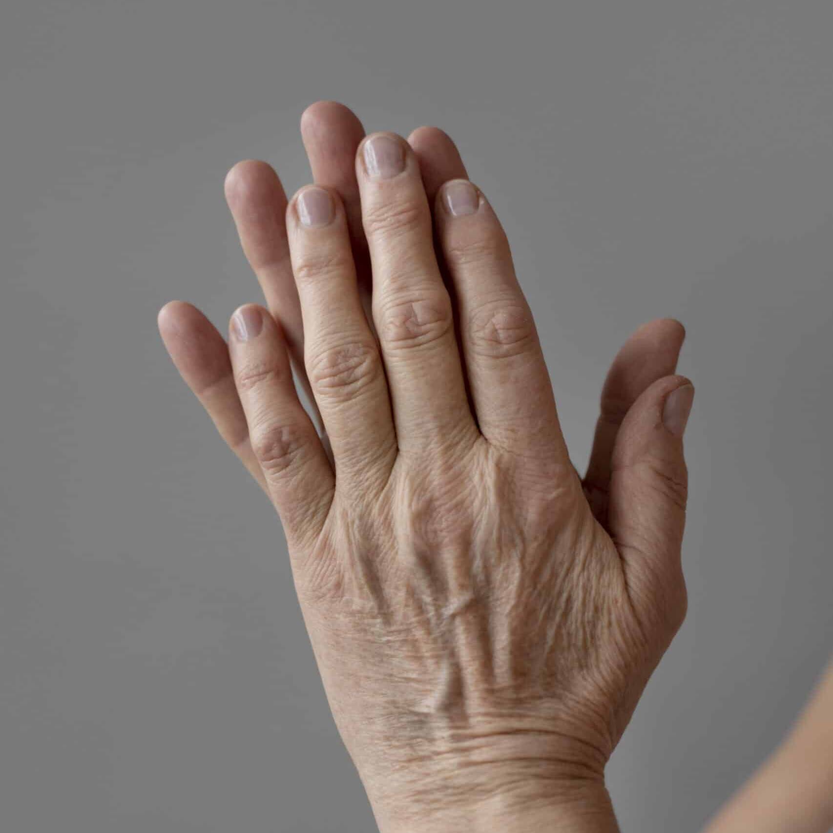 O dorso das mãos, colo e pescoço são áreas frequentemente esquecidas nos cuidados com a pele, mas merecem atenção e cuidado. Os Biostimuladores de Colágeno ajudam a preencher essas áreas, reduzindo a aparência de linhas finas e proporcionando uma aparência mais jovem e uniforme.